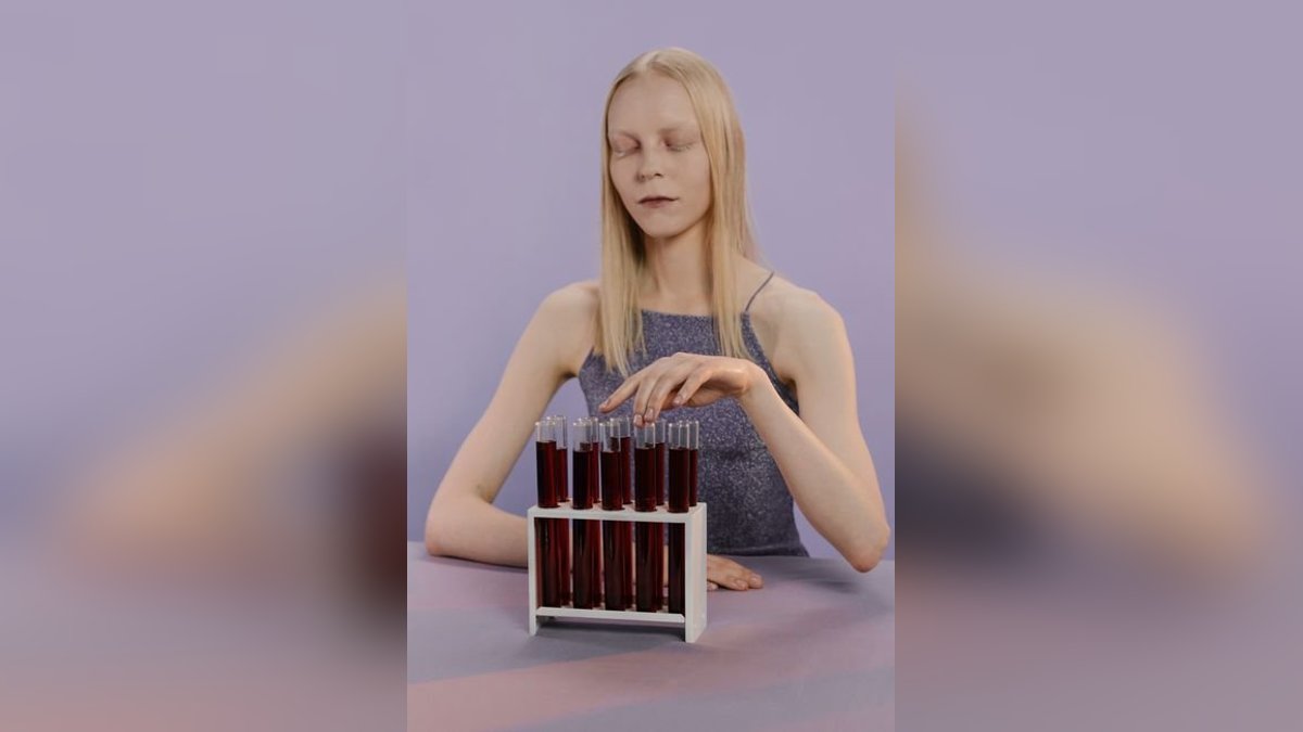 Iron Deficiency Anemia: A Complete Guide